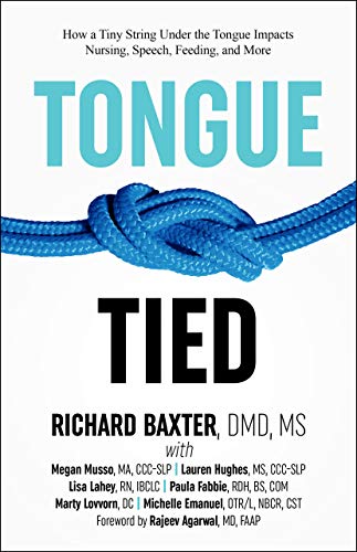 Tongue-Tied: How a Tiny String Under the Tongue Impacts Nursing, Speech, Feeding and more